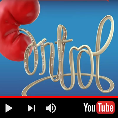 Animated Infomercial